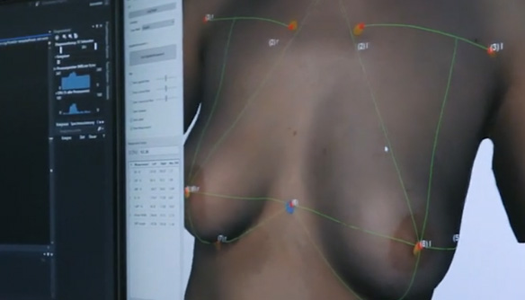 Bildschirm mit Breast Shape Model